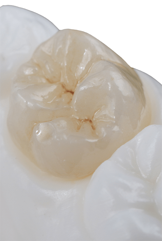 Zirconia tooth